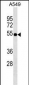 ZFP36L2 Antibody (Center)